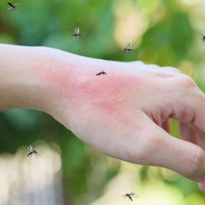 4 Signs of a Mosquito Infestation